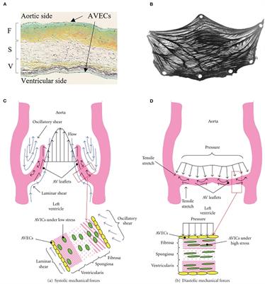 Frontiers | Calcific Aortic Stenosis—A Review On Acquired Mechanisms Of ...